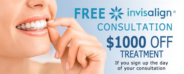 Invisalign Clear Aligners Los Angeles