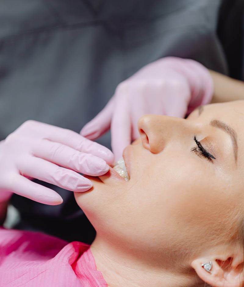 Tooth Extraction Los Angeles